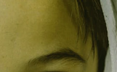 �茑�˵�üë�ĺ��~�þ�